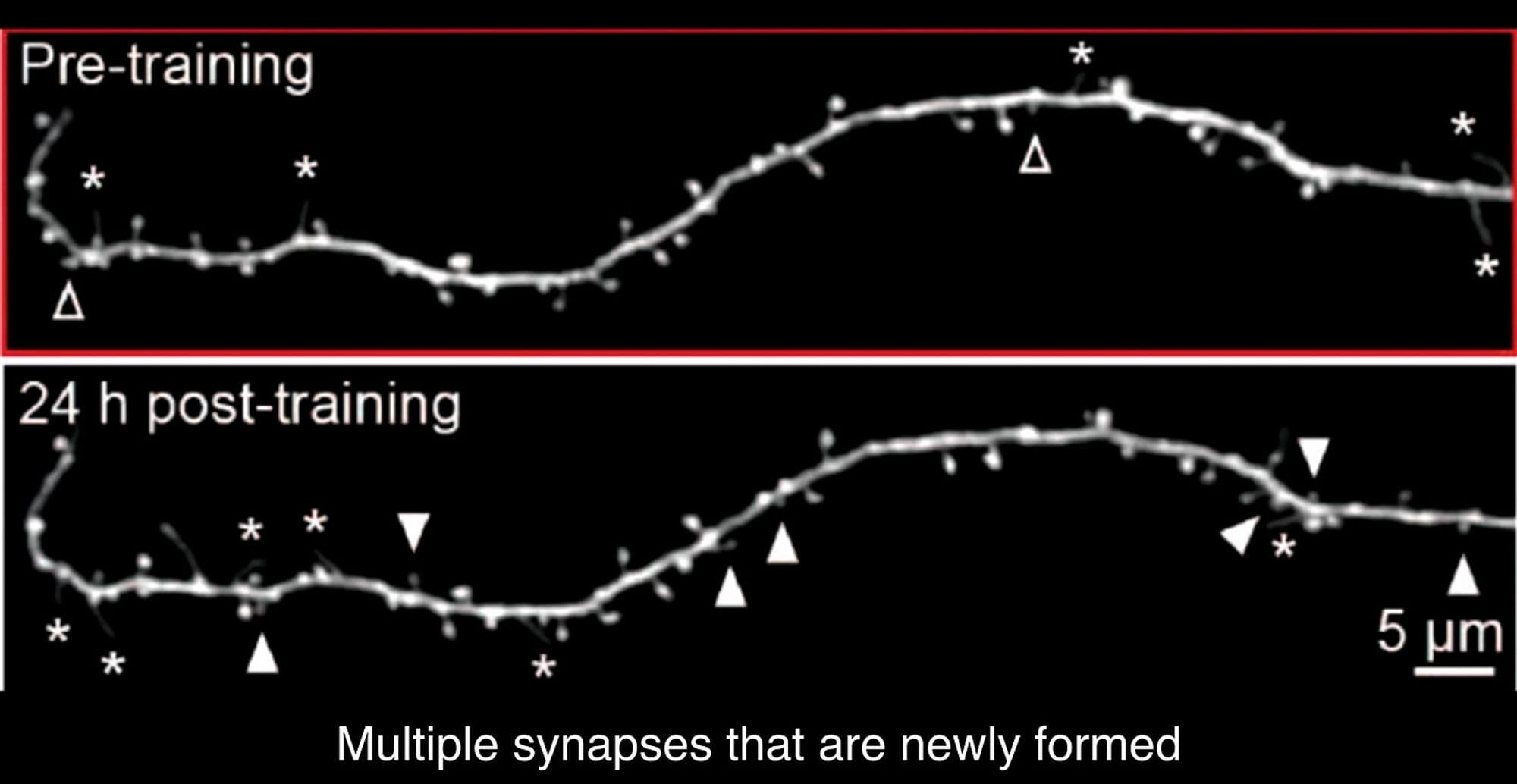 Synapses